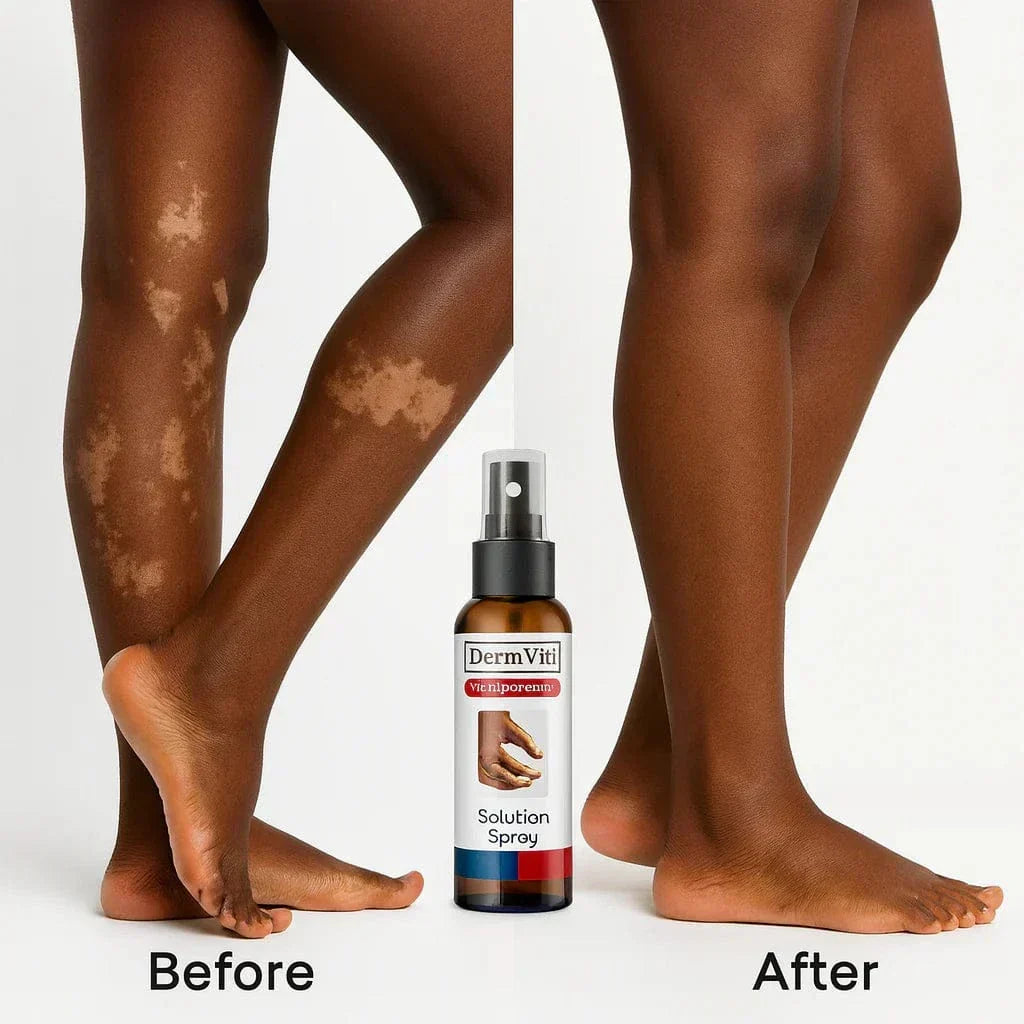 Spray Solution Réparatrice de la Peau Vitiligo