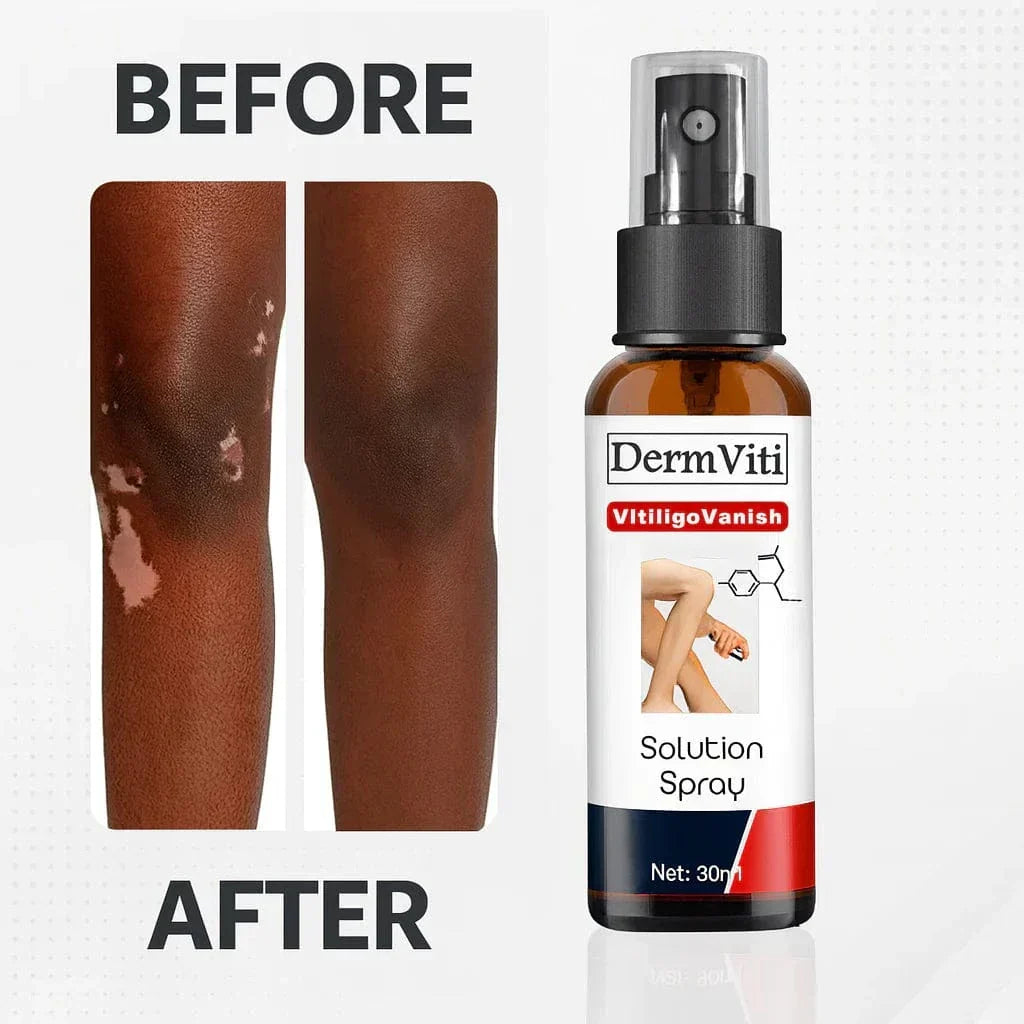 Spray Solution Réparatrice de la Peau Vitiligo